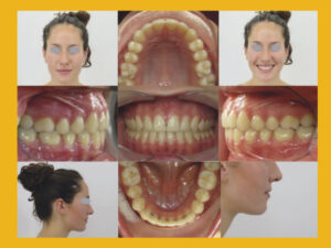 La photographie au cabinet d’orthodontie en Bretagne